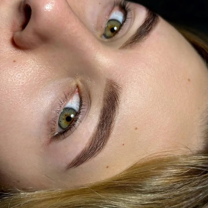 Forehead Wrinkles, Nasolabial Folds and Carboxytherapy