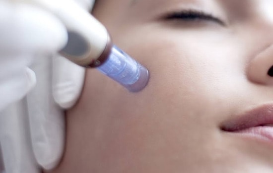 Fractional Mesotherapy