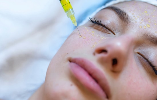 Mesotherapy (Homeomesotherapy)